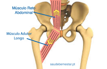 Músculos Adutor Longo e Reto abdominal