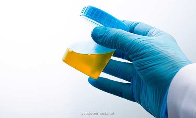 Análise de urina tipo II
