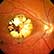 /pt/clinica/oftalmologia/toxoplasmose-ocular/