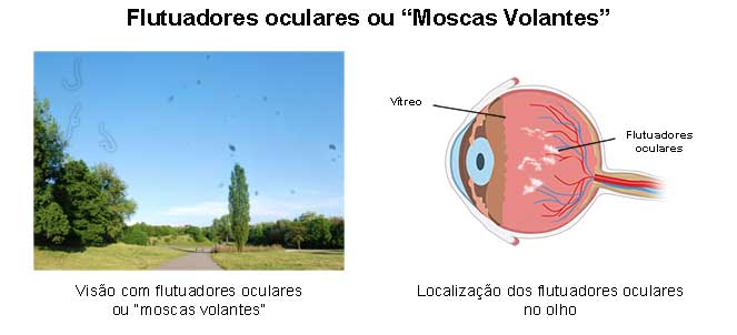 Mosacas volantes