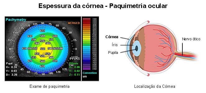 Exame ocular de paquimetria, fotos, imagens