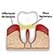 /pt/medicina/dentaria/gengivite/