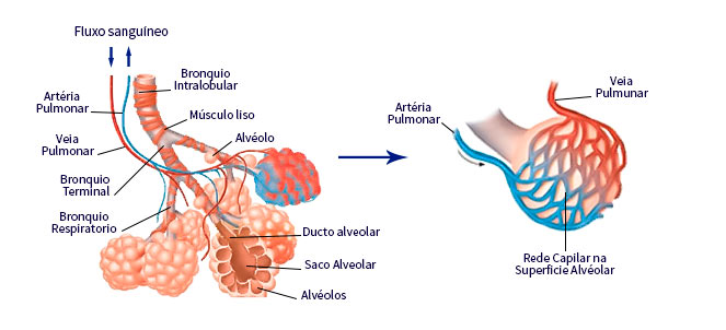 Enfisema pulmonar