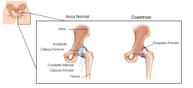 tratament articular în formă