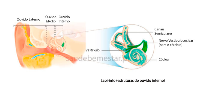 Labirintite - fotos , imagens