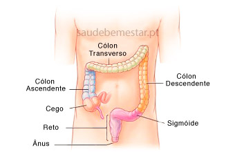 Desvio do septo nasal