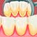 /pt/medicina/dentaria/tartaro-nos-dentes/