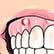 /pt/medicina/dentaria/abcesso-dentario/