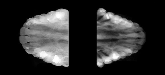Radiografia oclusal , fotos, imagens
