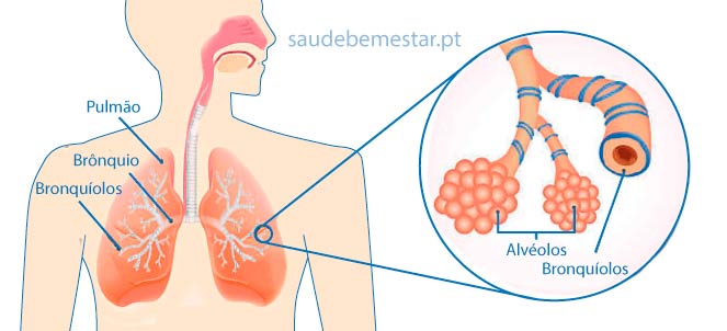 Diabetes Tipo 2 Causas Sintomas E Tratamento