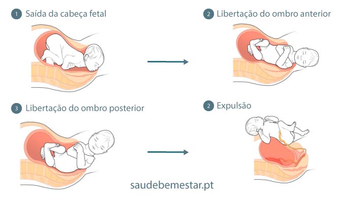 Parto normal. Vantagens do parto normal. - Brasil Escola