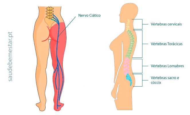 Fotos do nervo ciático