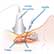 /pt/exame/imagiologia/biopsia-da-tiroide/