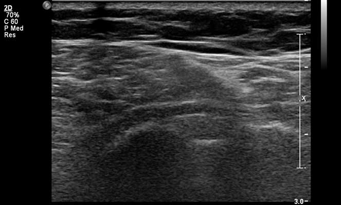 Fotos de ecografia dos tecidos moles