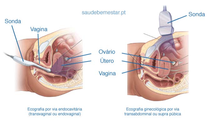 lumanari pentru lista de prostatite