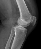 Radiografia do joelho
