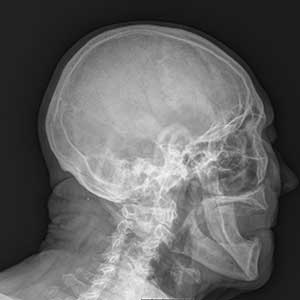 Radiografia do crânio