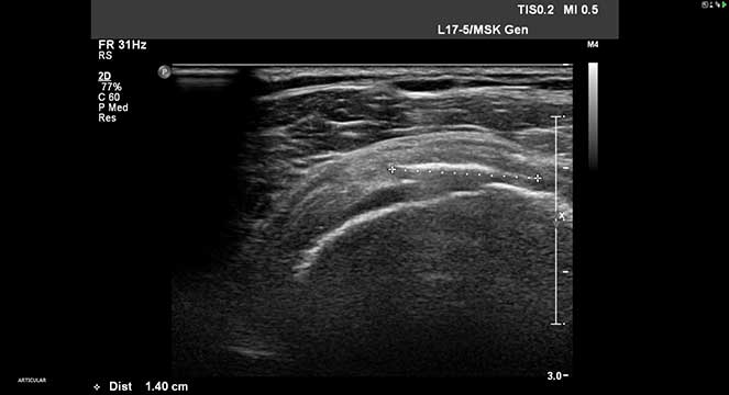 Fotos de ecografia articular
