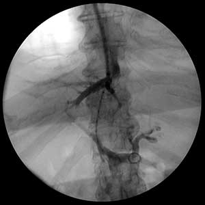 Radiologia de Intervenção