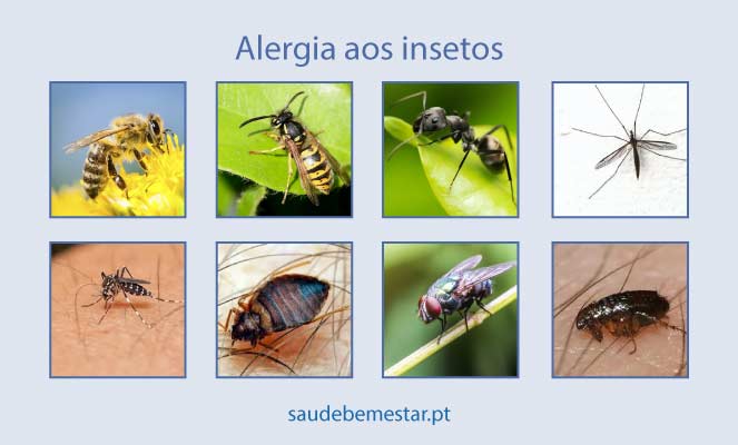 Imagens de alergia a insetos
