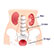 /pt/medicina/nefrologia/insuficiencia-renal/