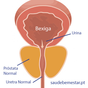 rău în tratamentul prostatitei cum poti trai cu prostatita