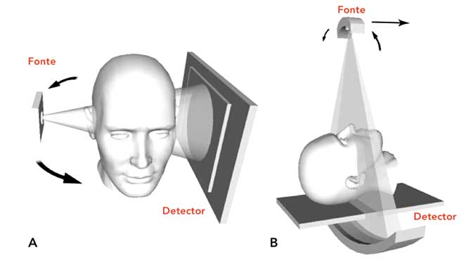 CBCT (Cone beam - CT)