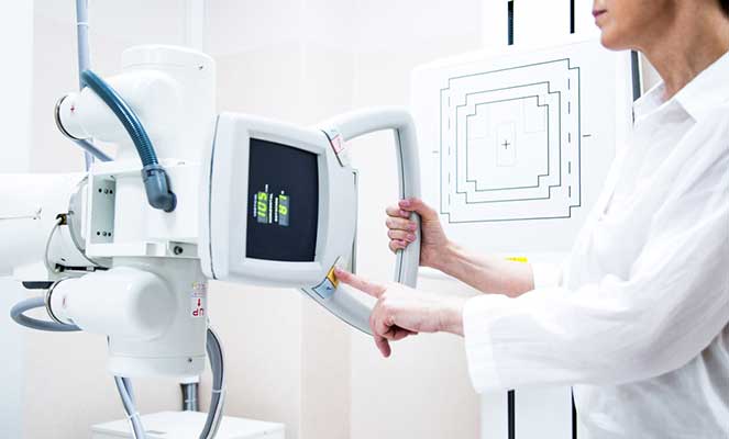 radiografia da clavícula