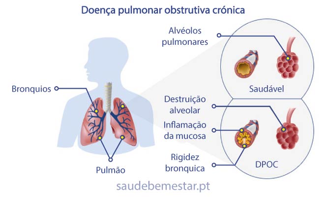 DPOC fotos, imagens