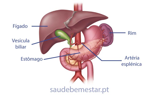 Fotos de Aneurisma esplénico