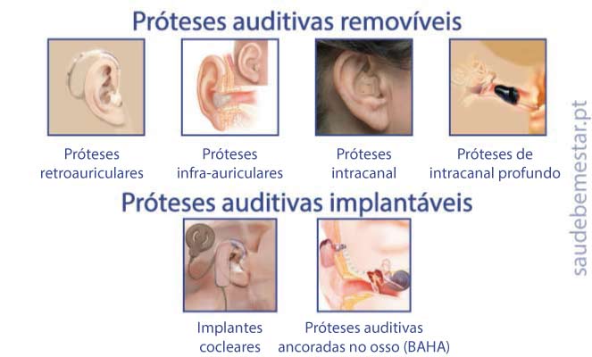 Fotos de aparelhos auditivos
