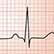 /pt/medicina/cardiologia/eletrocardiograma/