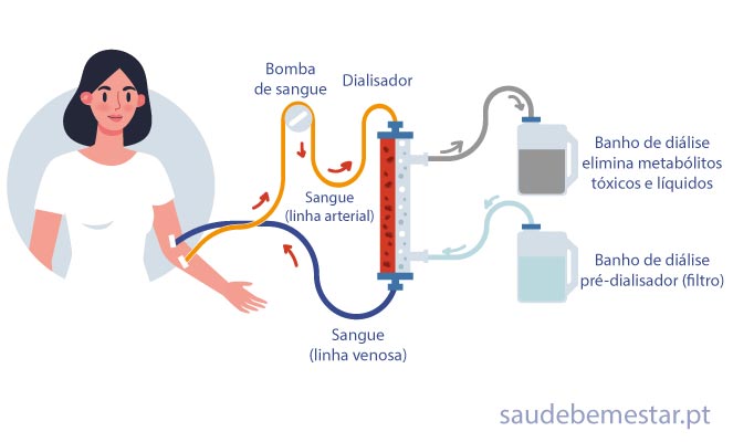 Fotos de diálise