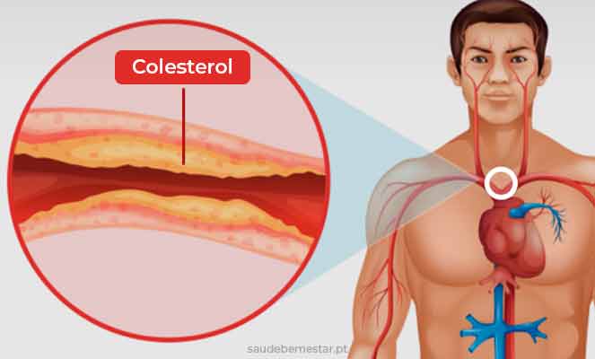 Colesterol