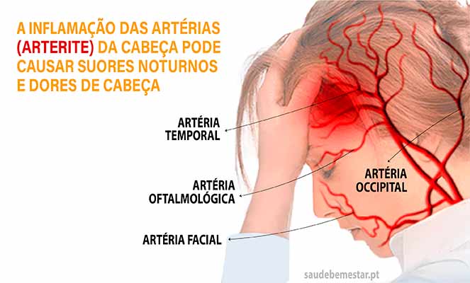 Arterite temporal