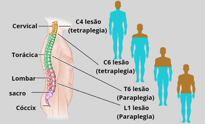 Lesões vertebro-medulares