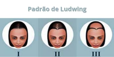 Padrão de Ludwing