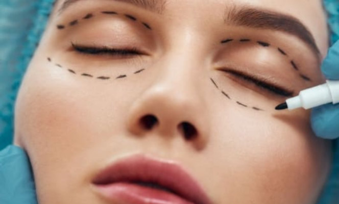 Harmonização facial