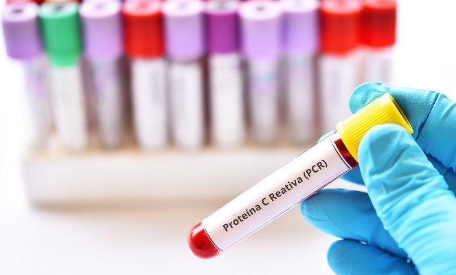 PCR
