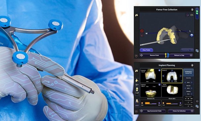 Robotica na cirurgia protese de joelho