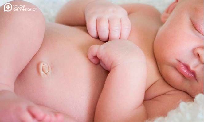 Hernia umbilical